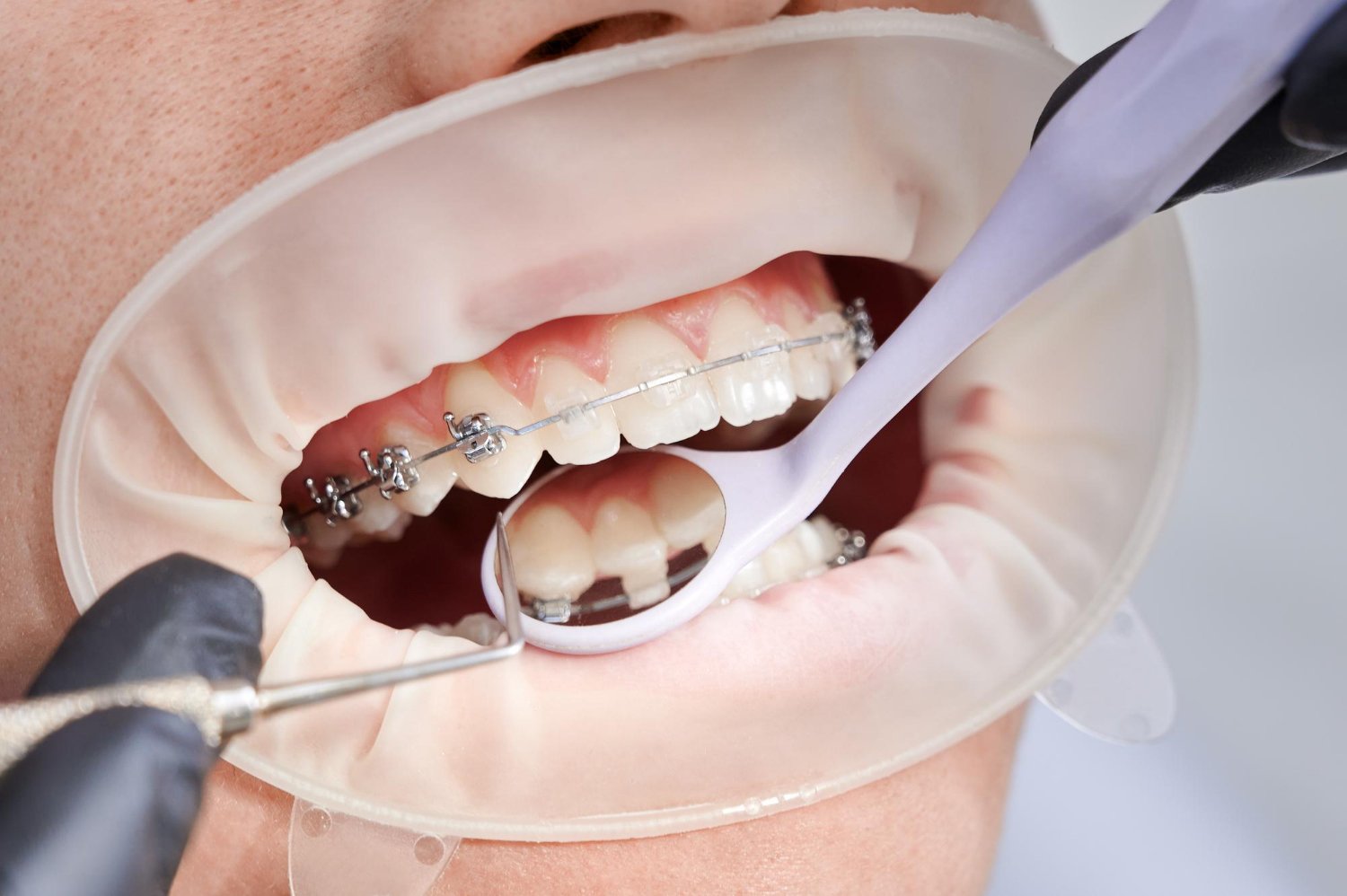modern orthodontics