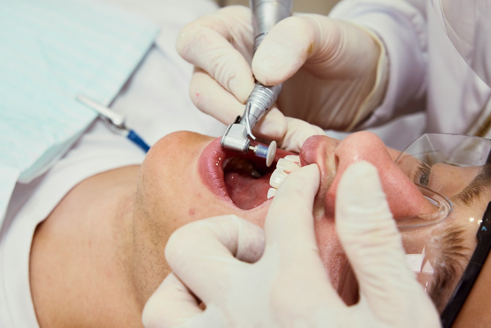 dental implants