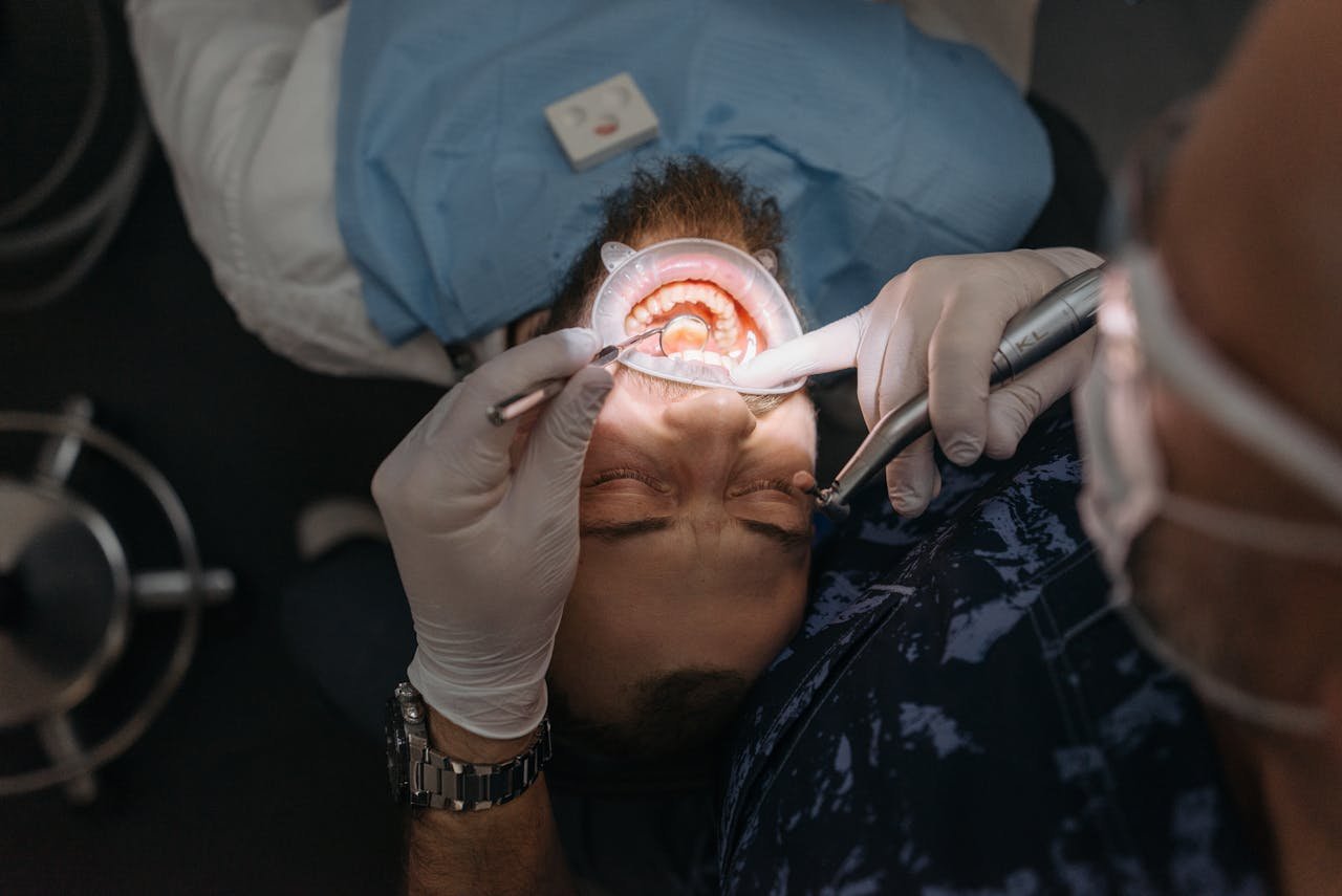 dental implants dental implants