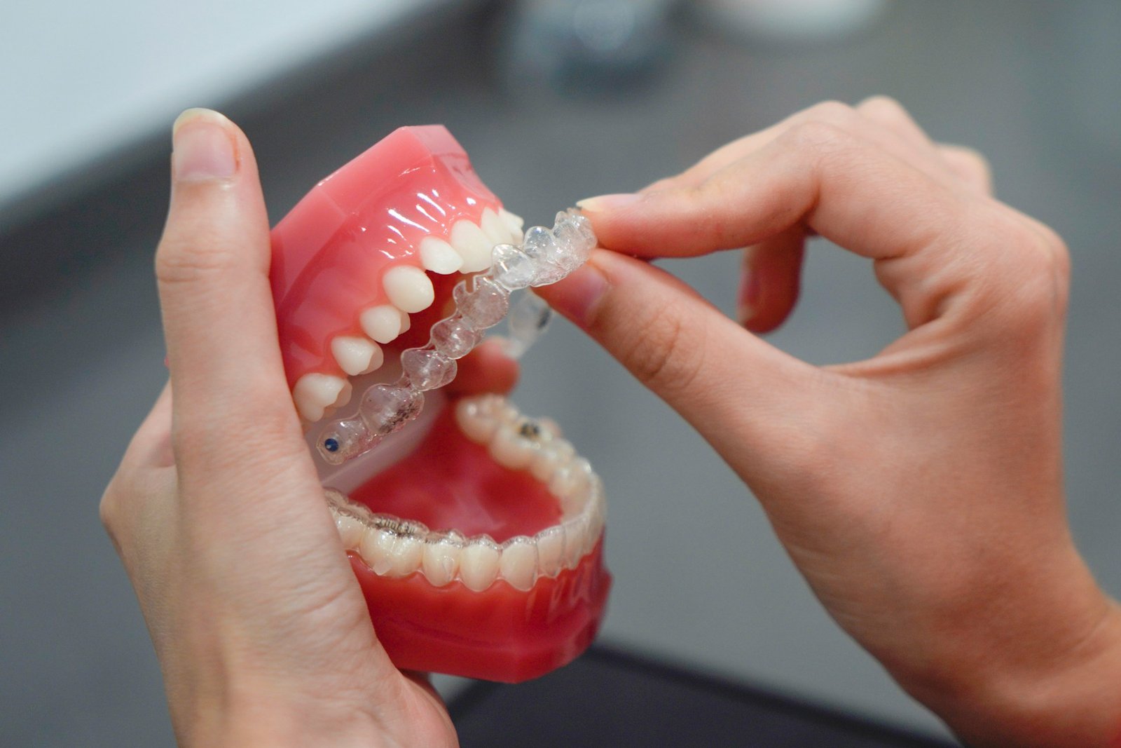 Invisalign Braces