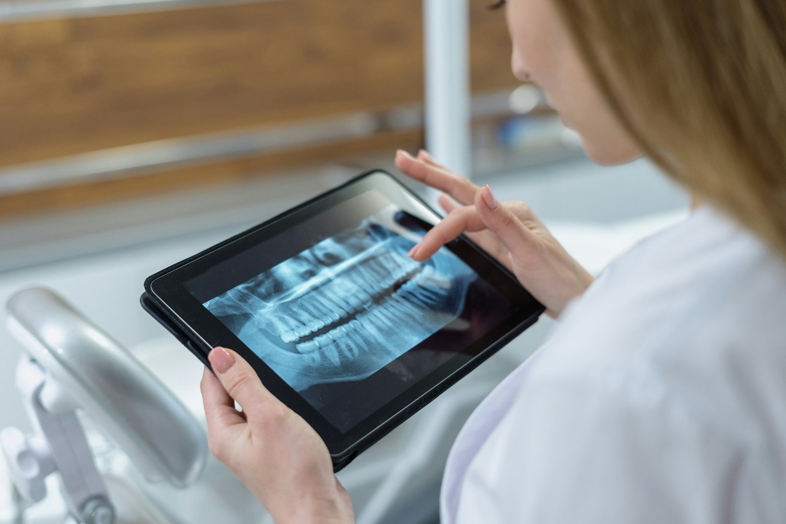 dental implants