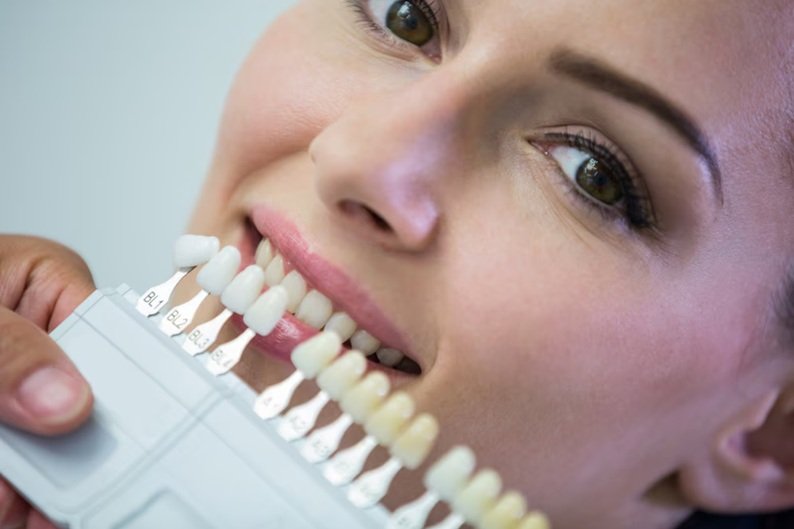 teeth whitening